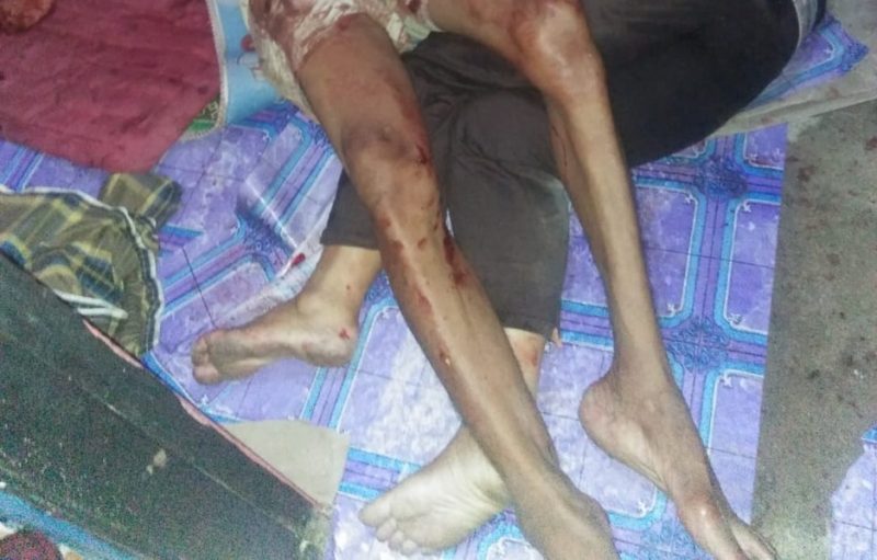 Diduga pembunhan suami sebut saja Nain dan Istri Naima kini istrinya sudah tidak bernyawa